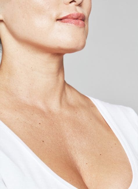 Restylane Skinboosters Before and After - Case 3, Image 1 - Female, age 35 – 44 - Montréal & Saint-Sauveur, QC - Clinique AG