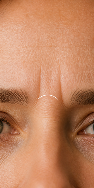 Ride du lion entre les sourcils sur un modèle générique