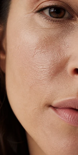 Détail de la joue illustrant des objectifs d'hydratation avec le Beauty Booster