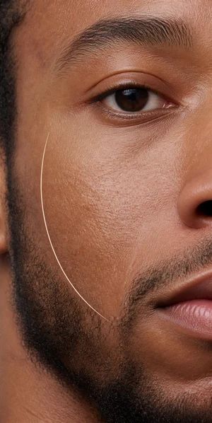 dry-looking skin texture