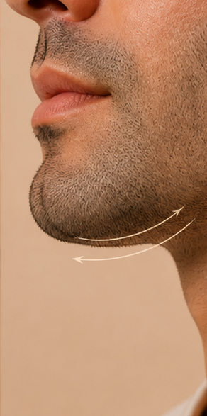 Jawline treatment area with curved guide lines for Hyaluronic Acid Dermal Fillers at Clinique AG in Montreal