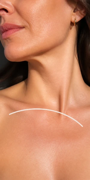 Lower-face and neck skin detail for Injectable Skin Revitalization skin-quality goals