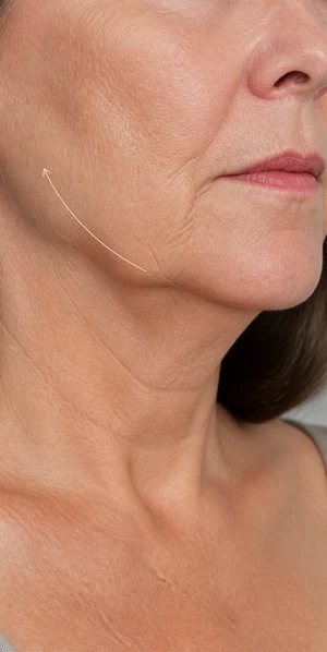 préoccupation de fermeté du bas du visage